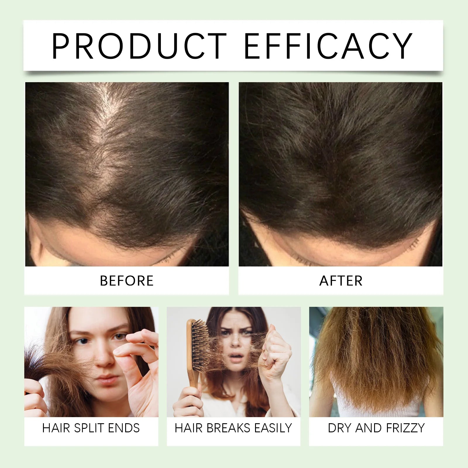 Rosemary Hair Growth Serum – Fast Hair Loss Solution