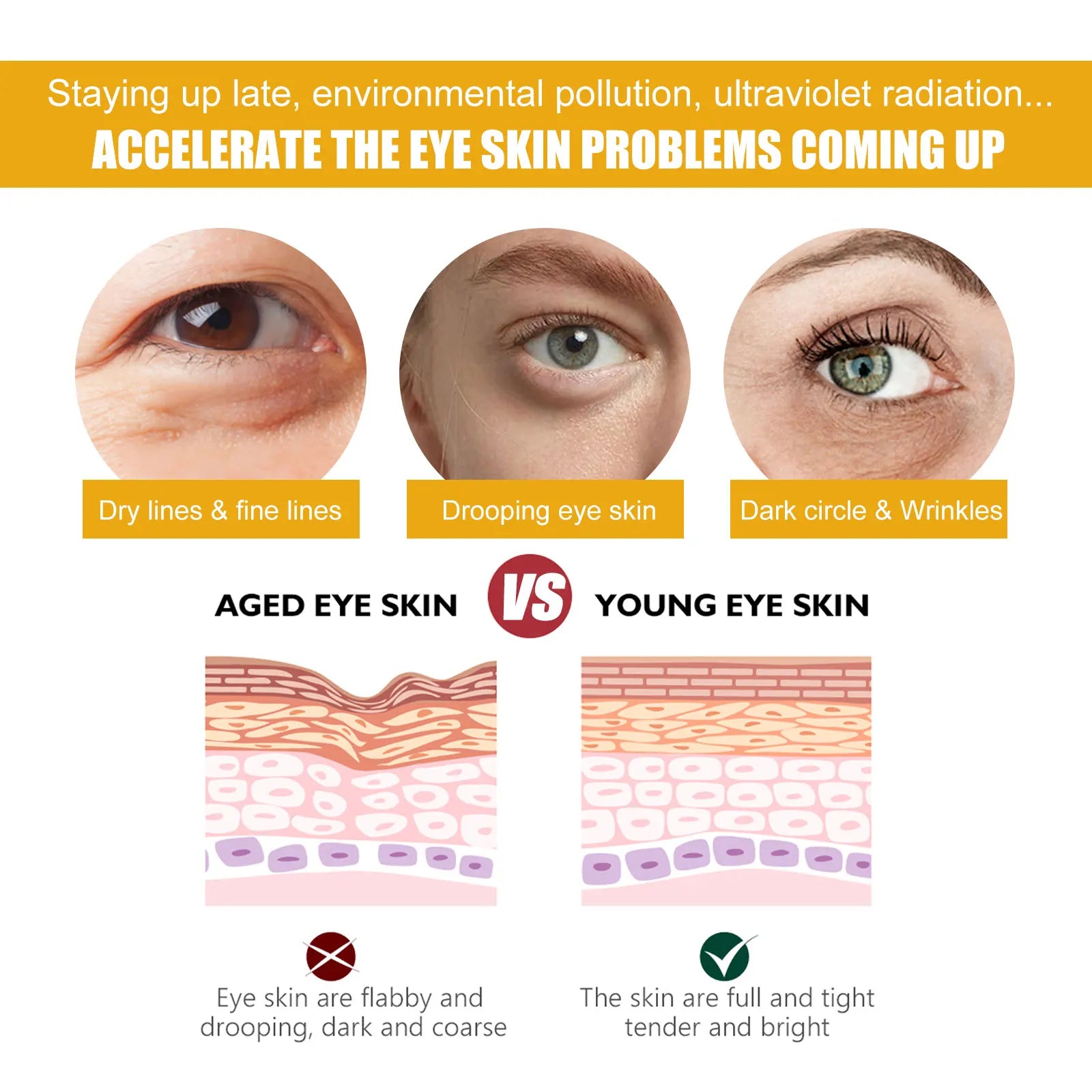 Eelhoe Turmeric Eye Cream – Dark Circle & Wrinkle Fighter