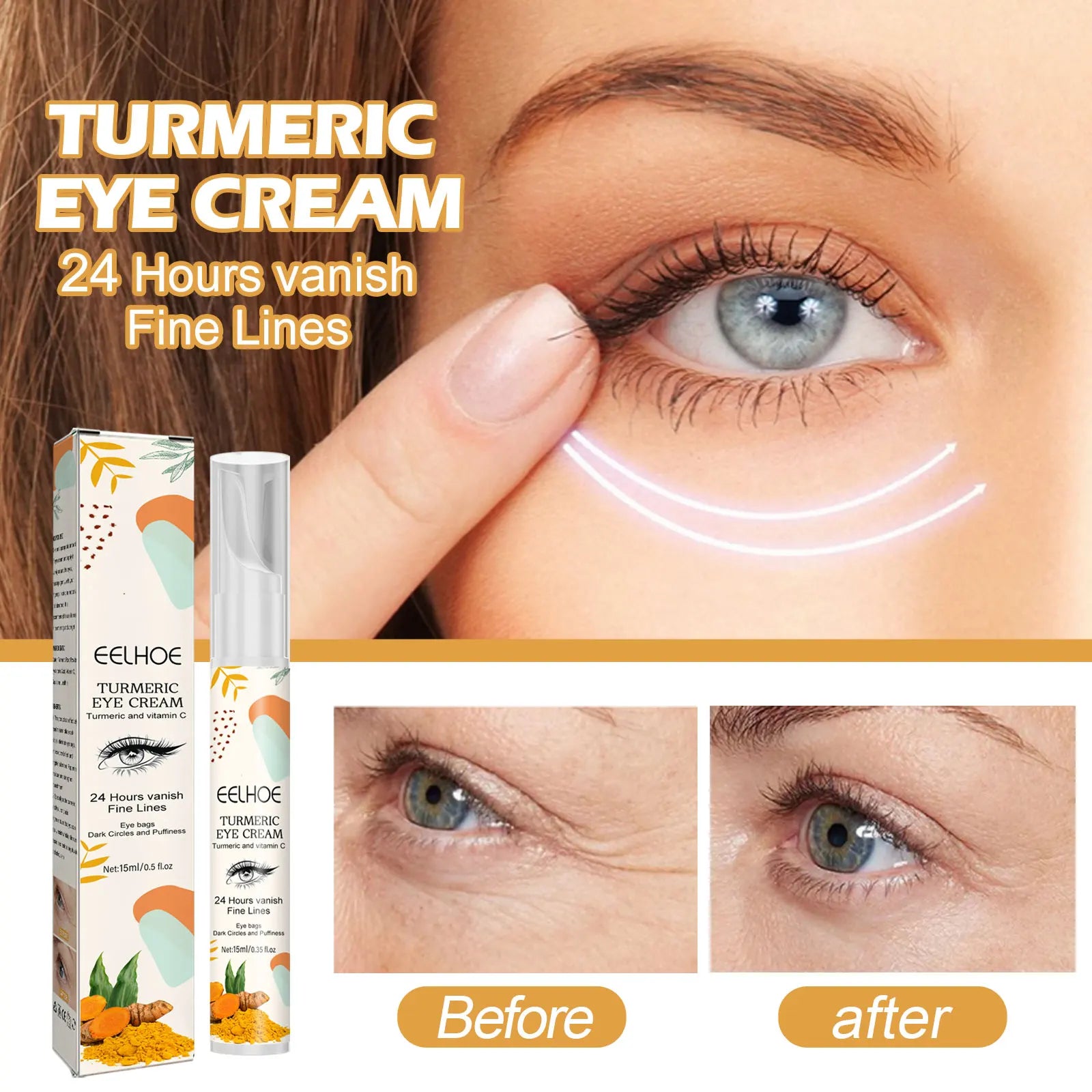 Eelhoe Turmeric Eye Cream – Dark Circle & Wrinkle Fighter