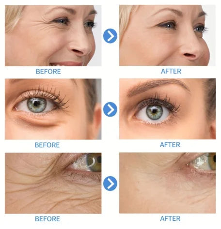 15ml Hyaluronic Acid Collagen Facial Essence