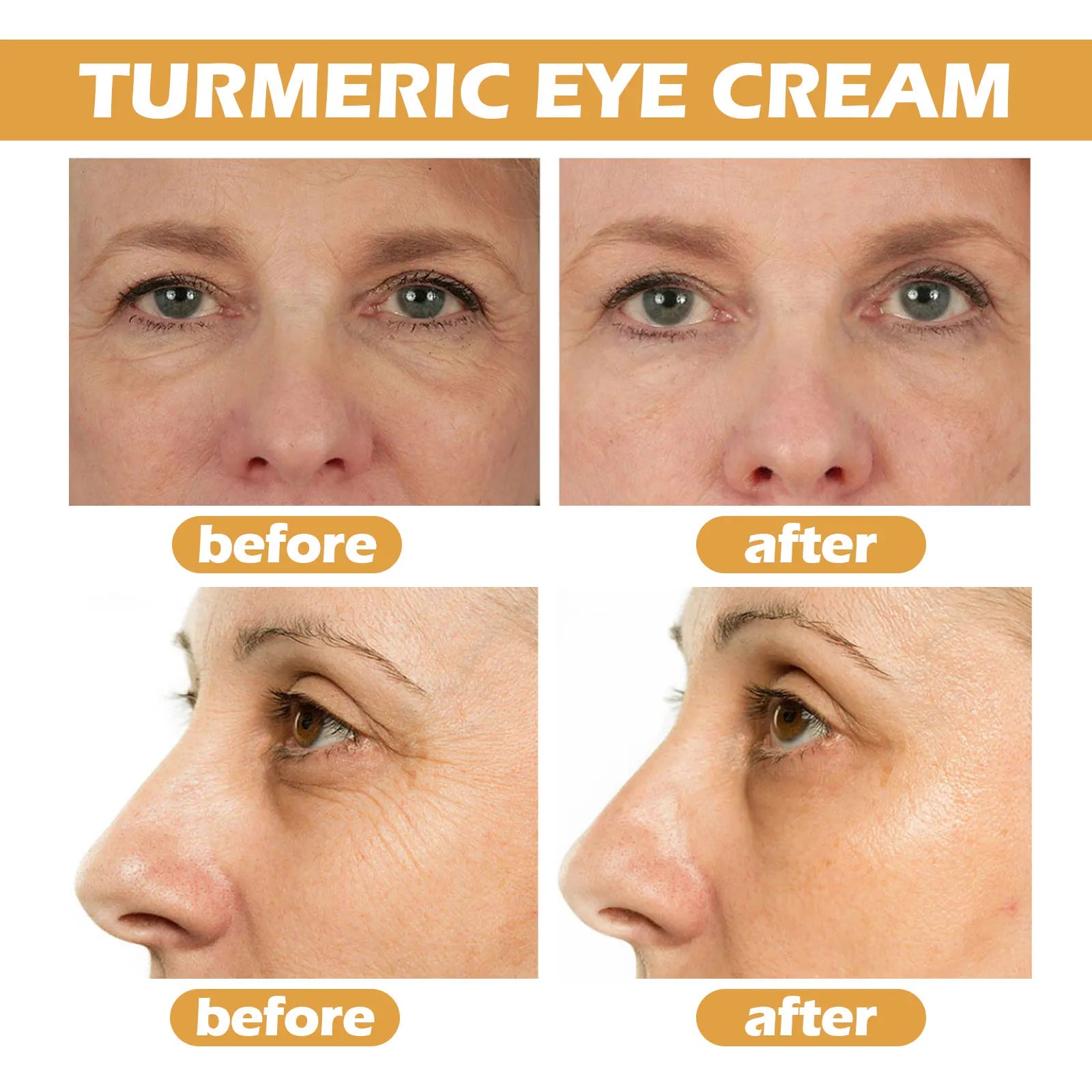 Eelhoe Turmeric Eye Cream – Dark Circle & Wrinkle Fighter