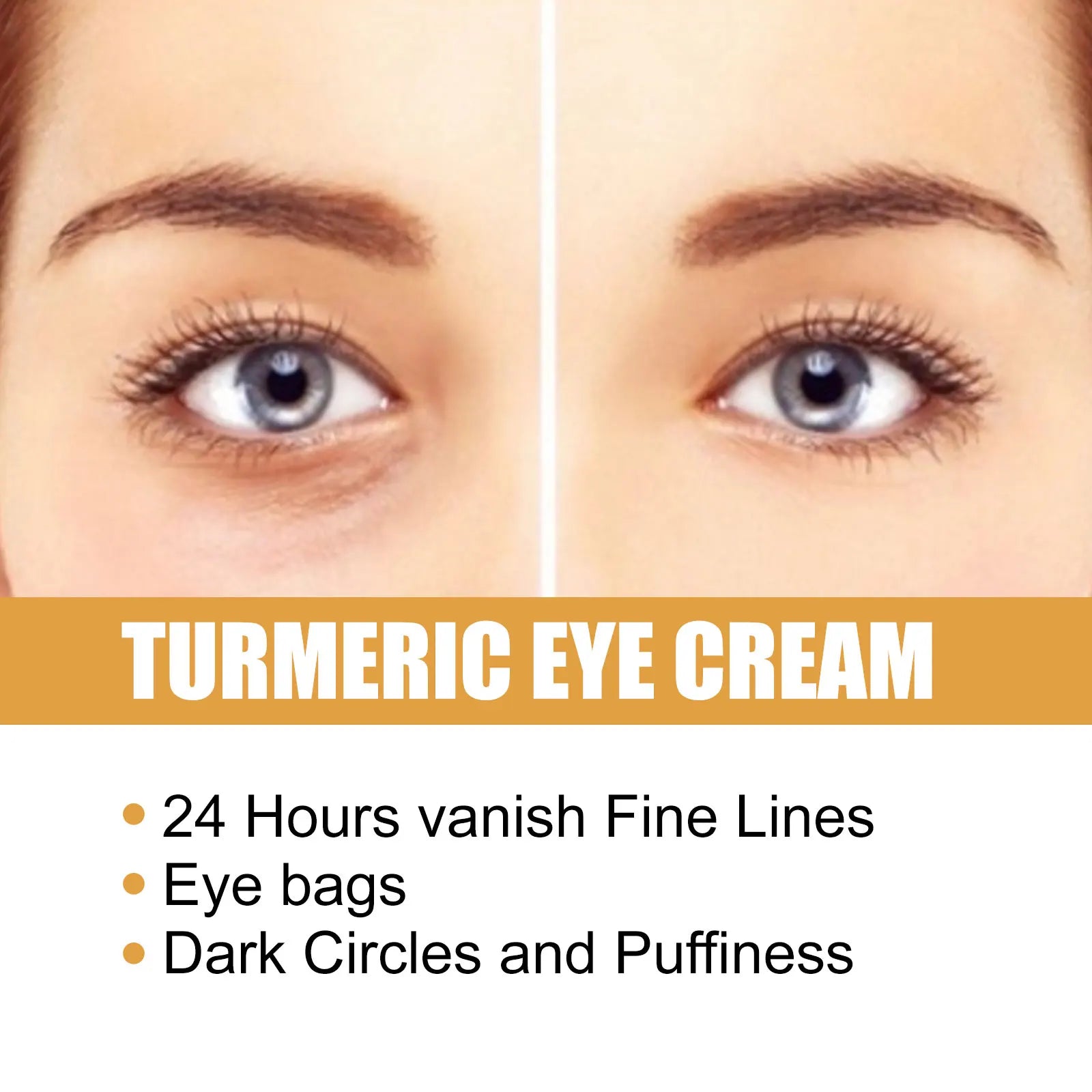 Eelhoe Turmeric Eye Cream – Dark Circle & Wrinkle Fighter